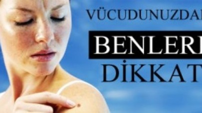 Vücuttaki benler kanserin habercisi olabilir!