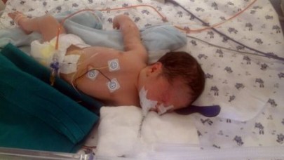 Mirza bebek için tıp çaresiz kaldı