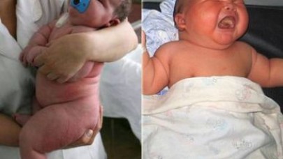 Dünya Bu Çocuğu Konuşuyor