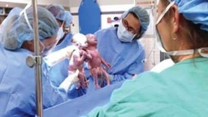 İkizler el ele dünyaya geldi !