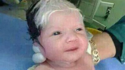 Siyah beyaz saçla doğdu