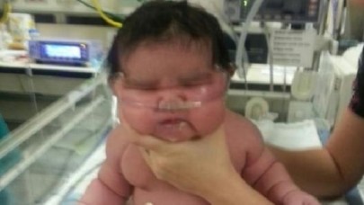 6.2 kilogram doğan bebek, görenleri şaşırttı