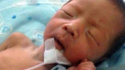 Mezardan çıkarıldı,hayata döndü