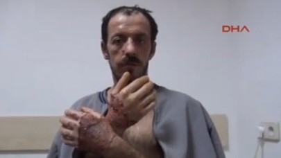 Oğlu sopayla vurdu, eşi benzin döküp yaktı