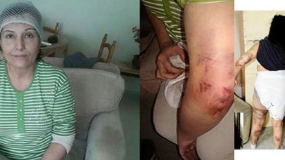 Komşusunu öldüresiye dövdü...