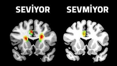 Aşkın MRını çektiler