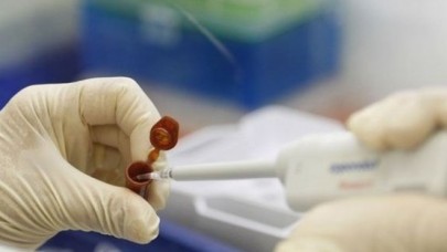 Diyarbakırda domuz gribi alarmı