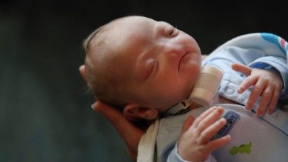 Burnu olmadan doğdu