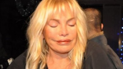 Ajda Pekkan Estetik Mağduru Oldu