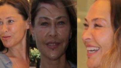 Hülya Avşar Estetiğin Dozunu Kaçırdı!