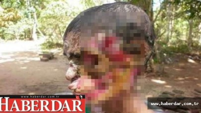 Et Yiyen Bakteri Türkiyede!