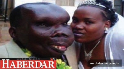 Ugandanın En Çirkin Adamı Paraya Para Demiyor