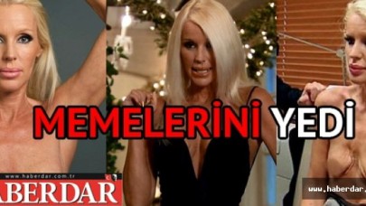 Göğüslerine et yiyen bakteri yerleşti