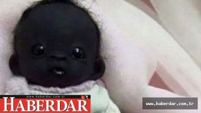 Dünyanın en siyah bebeği