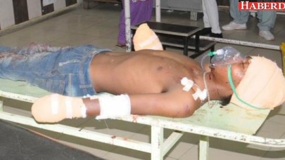 Baba, 8 Aylık Bebeğine Tecavüz Eden Gencin Ellerini Kesti