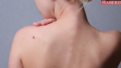 Vücudumuzdaki Gizli Tehlike: Benler