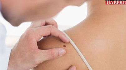 Hangi benler kanser belirtisi?