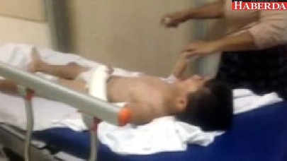 Sokakta Oynayan 2 Çocuk Magandanın Hedefi Oldu