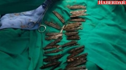 Tadı güzel diye 40 tane bıçak yuttu