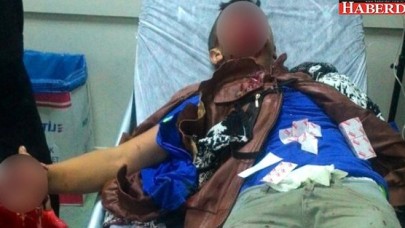 Polise Atmak İstediği Bomba Elinde Patladı