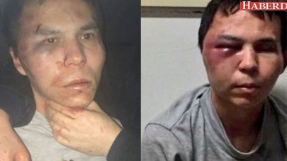 Sigara izmariti ele verdi!