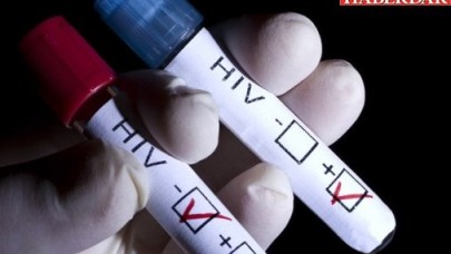 AIDS Hastaları Artık Uzun Yıllar Yaşayabilecek
