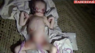 Hindistandaki uzaylı bebek herkesi şaşırttı!