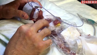 Türkiyenin En Küçük Bebeği 310 Gram!