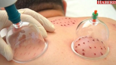 Hacamatı artık aile hekimleri yapacak!