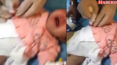 Serumu çıkartırken 1,5 aylık bebeğin parmağını kesti