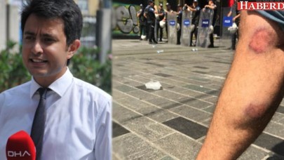 İGD, Gazeteci Özgür Deniz Kaya’ya yapılan saldırıyı kınadı...