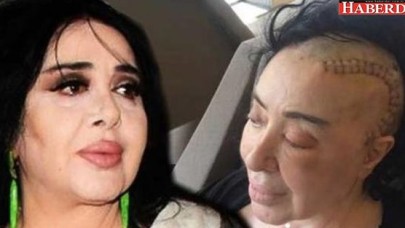 Nur Yerlitaş: Kemoterapi beni çok yordu