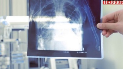 Meslek hastalıkları yeterince bilinmiyor