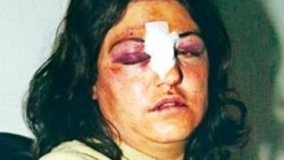 Sigara mı içiyordun dayağı