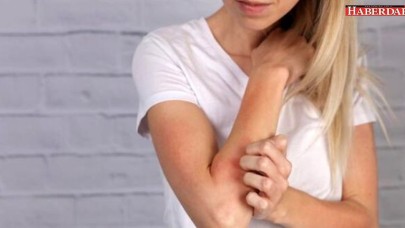 Yurt genelinde uyuz salgını var, ilaçlar tükendi