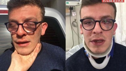 Avcılarda otizmli gence darp eden kişi hakkında yeni gelişme