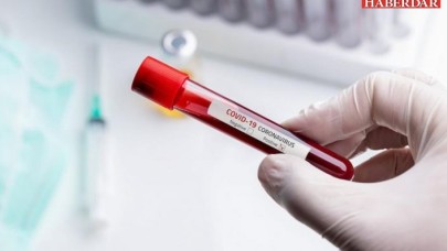 Spor Bakanı Kasapoğlu koronavirüs önlem paketini açıkladı