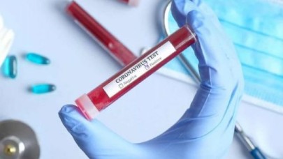 Türkiyede hangi hastanelerde Koronavirüs testi yapılıyor?