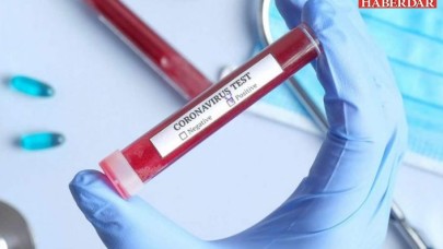 Koronavirüs testi yaptıranlar sonuçlarını nereden öğrenebilirler? Sağlık Bakanlığı açıkladı