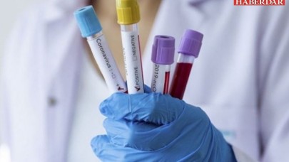 Covid - 19 muhtemelen sonsuza dek bizlerle kalacak