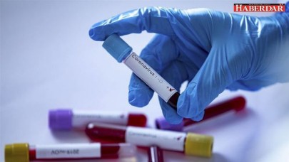 Corona virüs aşısında ilk adım atıldı