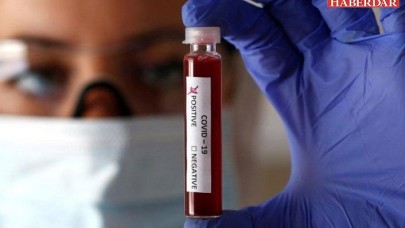 Koronavirüs kan yoluyla bulaşır mı?