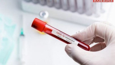 Dünya genelinde koronavirüs bilançosu: Ölü sayısı 134 bin 669