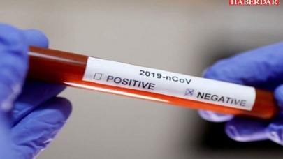 Koronavirüsten ölen bazı hastaların test sonucu nasıl negatif çıkıyor?