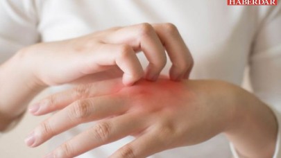 Doç. Dr. Zekayi Kutlubay uyardı! Koronavirüsün erken belirtisi olabilir