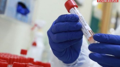 TTBden iki aylık koronavirüs raporu: Ölüm sayıları şeffaf değil