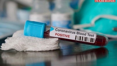 Test kriterleri değişiyor: Sağlıklı kişilere de Kovid-19 testi yapılacak