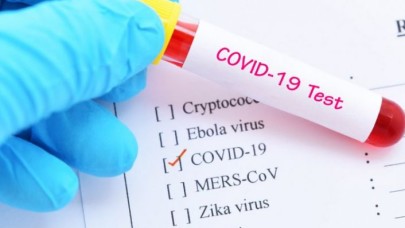 Vaka sayısında korkutan artış!