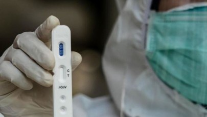 Prof. Dr. Ateş Kara paylaştı: Hangi kan grubu daha avantajlı?