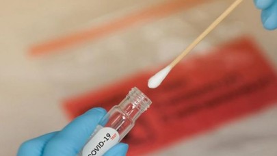 Sağlık Bakanlığı açıkladı: Fazla ücret alıp sonuçları sisteme girmemişler